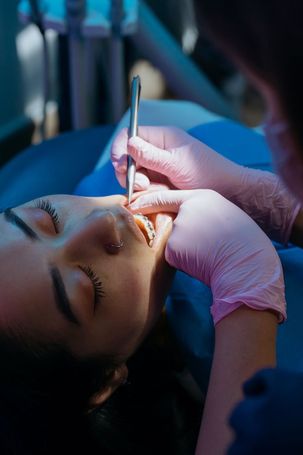 Exploración de los dientes con espejo dental; fotografía ilustrativa